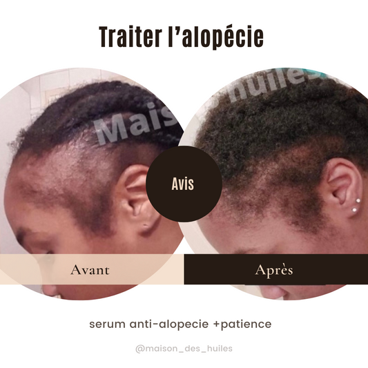 Sérum de repousse Cheveux & barbe