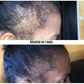 Sérum de repousse Cheveux & barbe