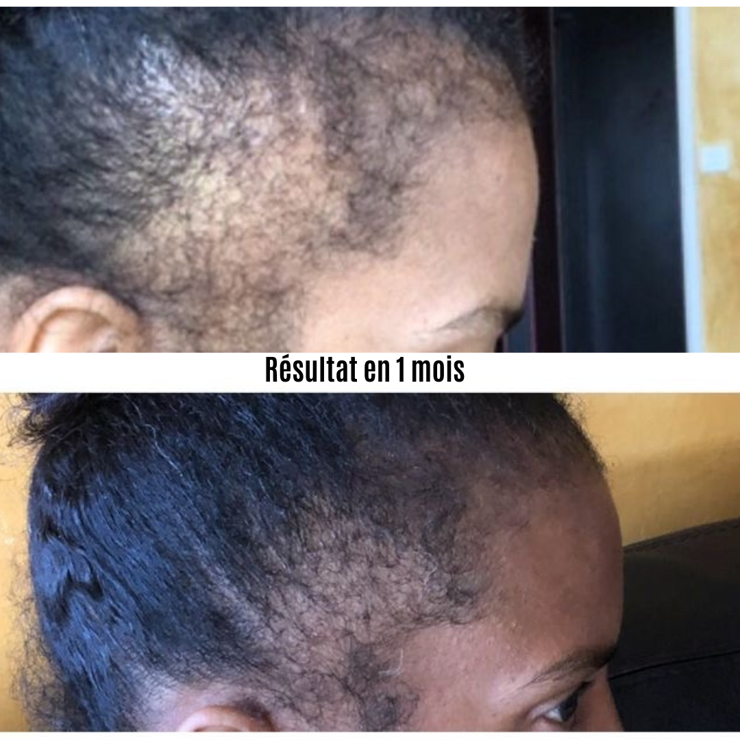 Sérum de repousse Cheveux & barbe