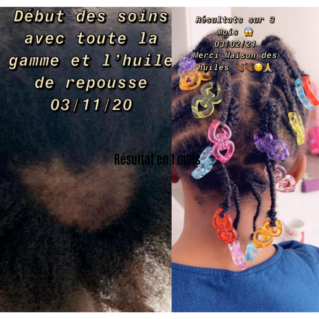 Sérum de repousse Cheveux & barbe